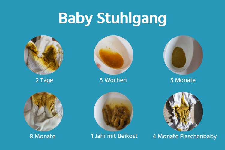 Stuhlgang Baby - Stillbaby und Flaschenbaby