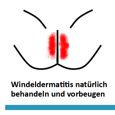 Windeldermatitis behandeln